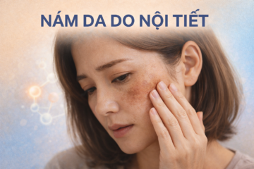 Nám Da Do Nội Tiết – Cách Phục Hồi Bền Vững